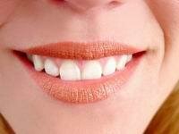 White light Teeth Whitener